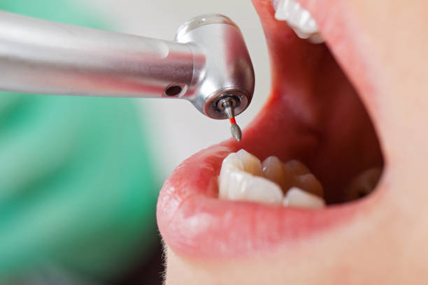 Best Mobile Emergency Dentist in Needville, TX
